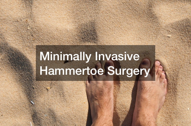 Minimally Invasive Hammertoe Surgery