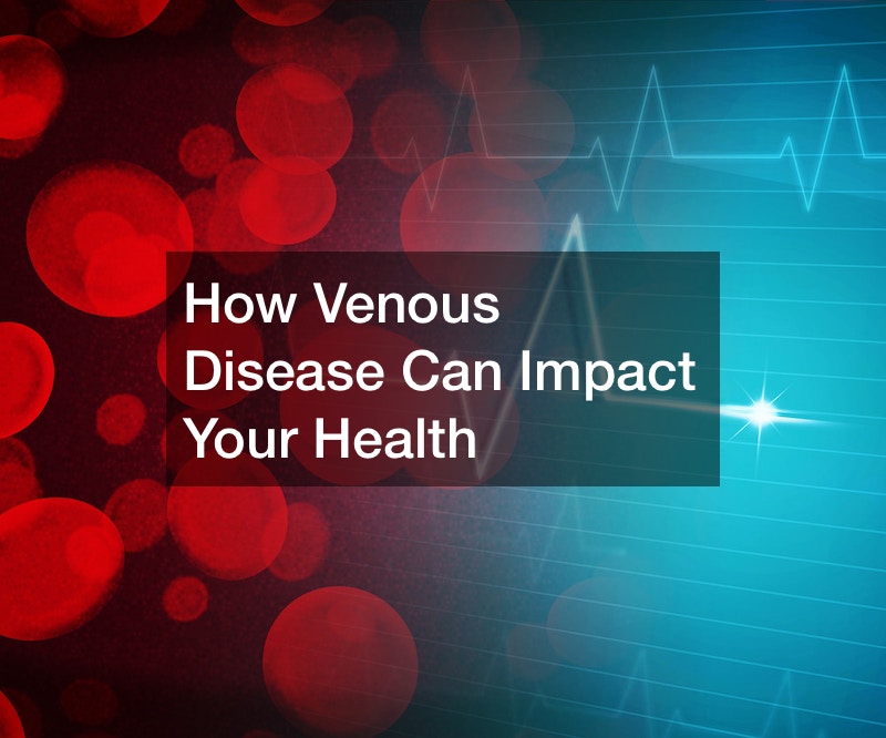 How Venous Disease Can Impact Your Health
